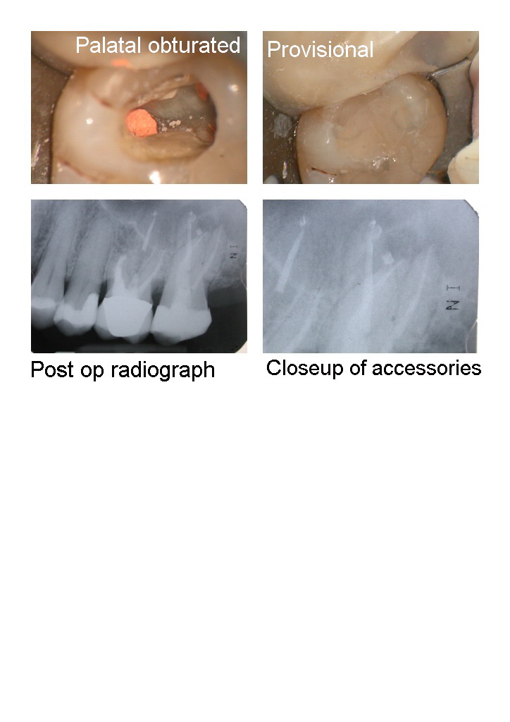 KW endo pg 3.jpg